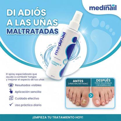 MEDINAIL | Recupera la Apariencia Saludable de tus Uñas
