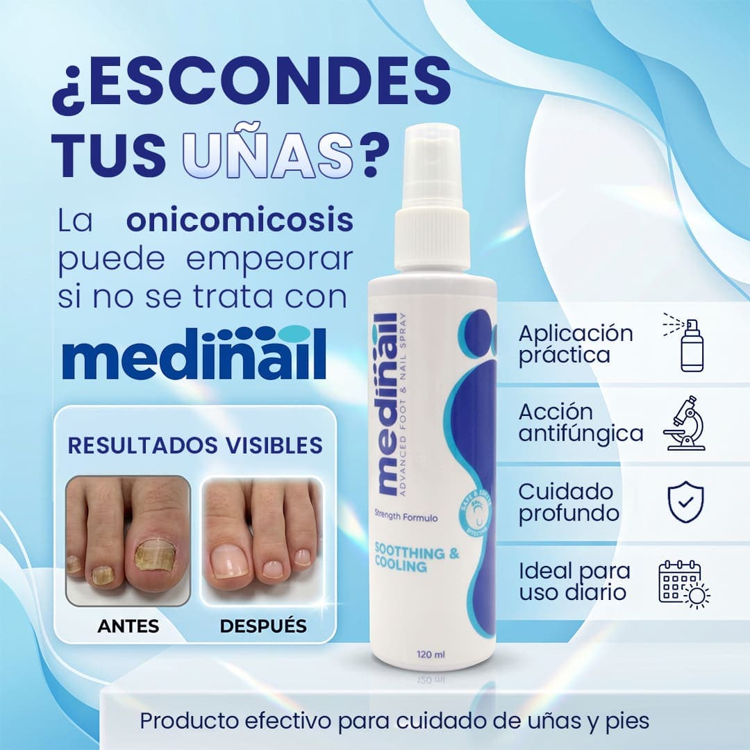 MEDINAIL | Recupera la Apariencia Saludable de tus Uñas